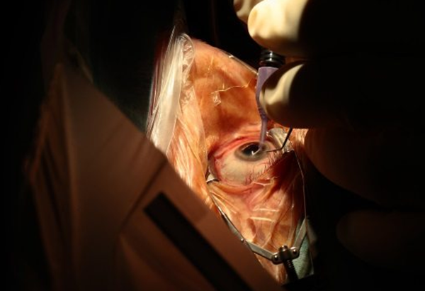 人体哪些器官不妨卖?盘点器官出卖十大简直事例