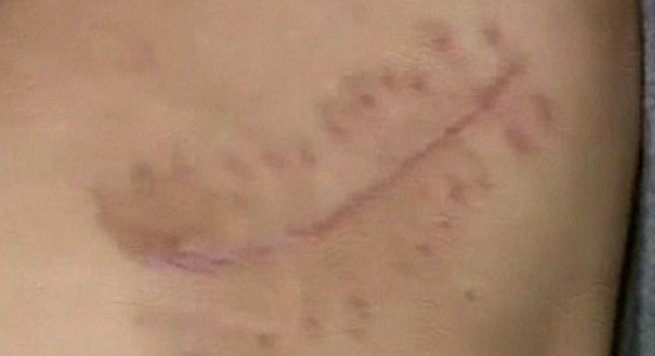 人体哪些器官不妨卖?盘点器官出卖十大简直事例