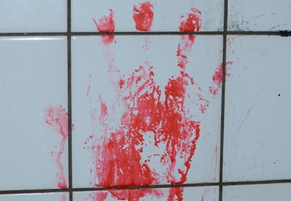 人体哪些器官不妨卖?盘点器官出卖十大简直事例