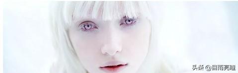 10种眼睛瞳孔颜色（瞳孔形状如此不同）(20)