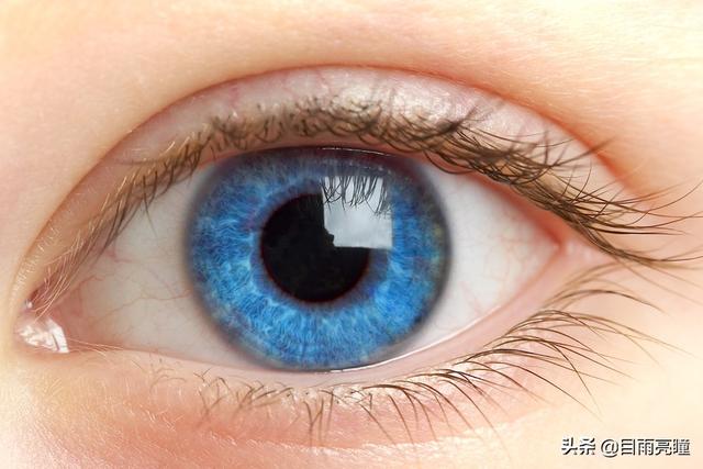10种眼睛瞳孔颜色（瞳孔形状如此不同）(2)