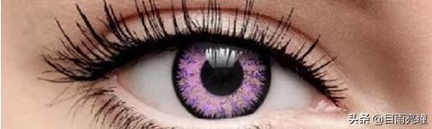 10种眼睛瞳孔颜色（瞳孔形状如此不同）(19)