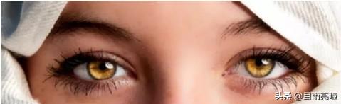 10种眼睛瞳孔颜色（瞳孔形状如此不同）(15)