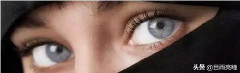 10种眼睛瞳孔颜色（瞳孔形状如此不同）(17)