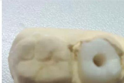 ​后槽牙是哪个地方