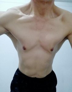 ​后腰两侧赘肉怎么减掉(骨盆前倾会造成减肥不成功吗)