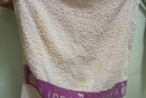 浴巾久了起黑点点怎么消除