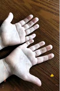 ​妈呀家人们！我一朋友愁死了。她家宝宝两只手都是断掌有什么说法