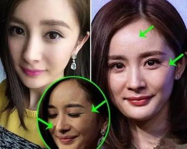 ​脸部皱纹祛除什么方法最好(脸上皱纹去掉的最好方法)