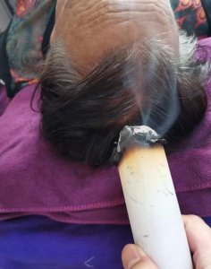 ​艾灸做后有什么注意事项可以天天做吗(艾灸的注意事项及禁忌)